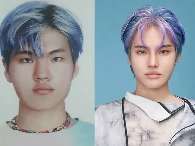Rapper Takuwa และรูปภาพก่อนและหลังการทำศัลยกรรมพลาสติกได้รับการเผยแพร่ ..