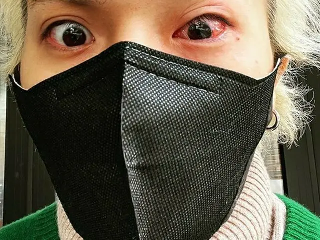 มิโน (WINNER) เปิดเผยสถานการณ์ล่าสุดตาแดงก่ำและเลือด เขาเล่าว่ามันเป็น "Twelve O