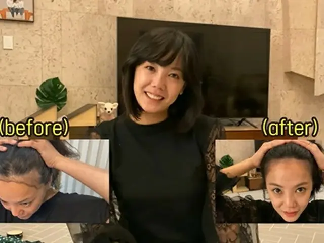 Actress Ko Eun A reveals three months after her hair transplant. .. ..