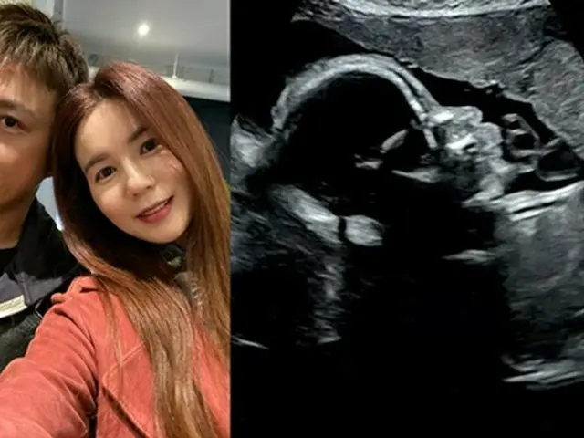 นักแสดง Kim Tae-hyun รายงานว่าหัวใจของเด็กในอ้อมแขนของ Park Si-eun ภรรยาของเขาหย