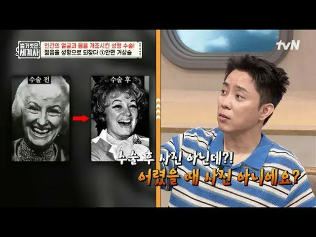 กำลังเล่นบนทีวี: ตอนที่ 216 | ศัลยกรรมเปลี่ยนแปลงใบหน้าและร่างกายของมนุษย์อย่างไ