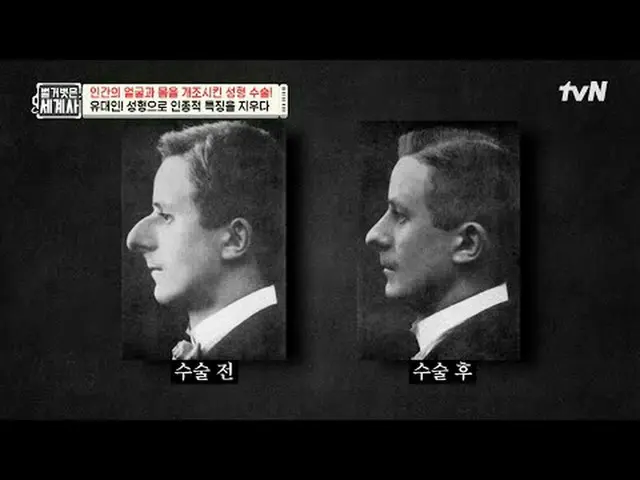 กำลังเล่นบนทีวี: ตอนที่ 216 | ศัลยกรรมเปลี่ยนแปลงใบหน้าและร่างกายของมนุษย์อย่างไ