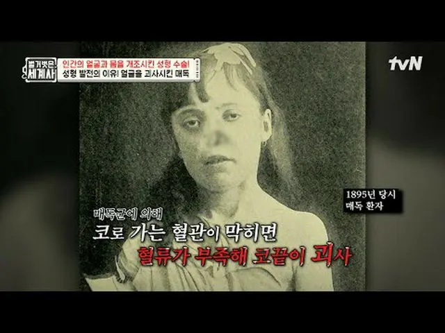 กำลังเล่นบนทีวี: ตอนที่ 216 | ศัลยกรรมเปลี่ยนแปลงใบหน้าและร่างกายของมนุษย์อย่างไ