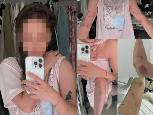 台湾人ユーチューバー、弘大で「一晩過ごそう」と誘われ…拒絶し暴行される=韓国