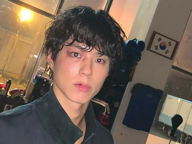 ใบหน้าของนักแสดงพัคโบกอมเต็มไปด้วยรอยแผลเป็น... เขาเปิดเผยภาพเบื้องหลังจากละครเรื่อง "Good Boy"